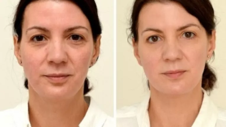 Experiment: consumul de apa ne intinereste cu cativa ani!