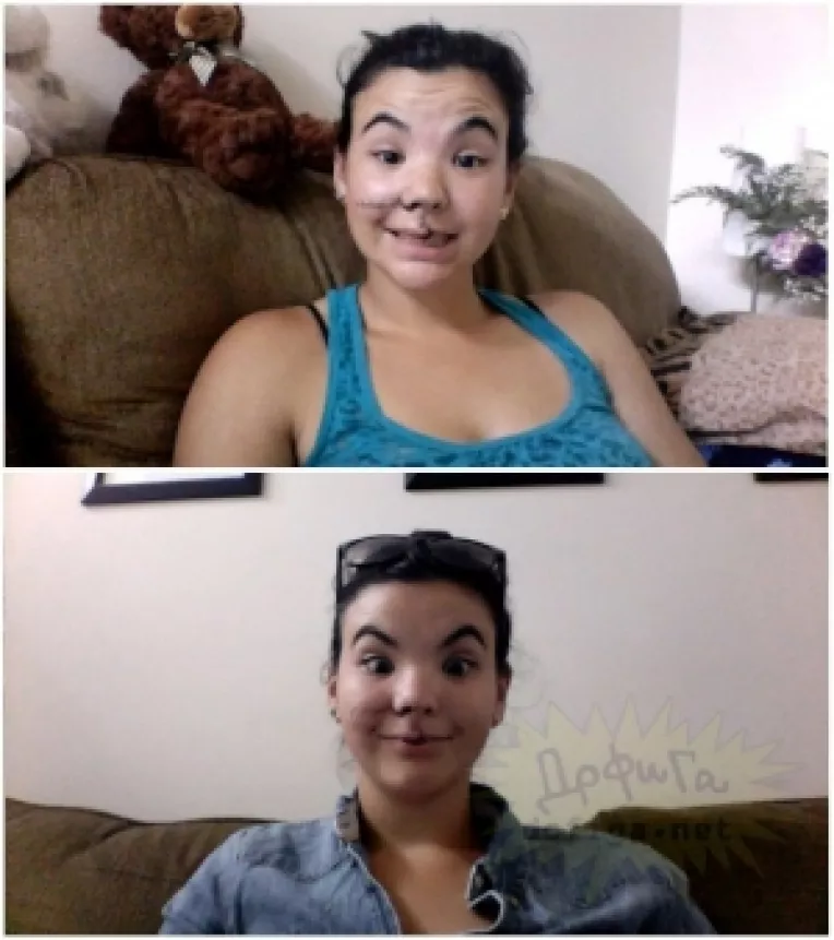 O tanara, mutilata de un cal